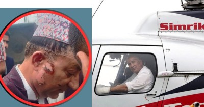  पोखरा भ्रमण वर्ष उद्घाटन गर्ने क्रममा बेलुन फुट्यो : अर्थमन्त्री र पोखराका मेयर घाइते, उपचारका लागि काठमाडौं ल्याइयो 