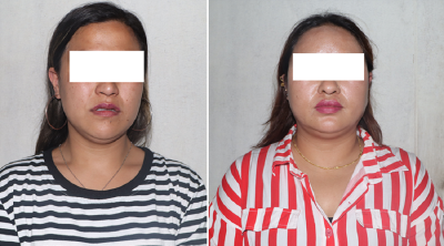  हनी ट्रयाप : नग्न फोटो खिची ५ लाख असुल, दुई महिला पक्राउ 