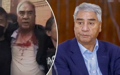  जेनजी आक्रमण : देउवाको टाउकोमा १२ टाँका 